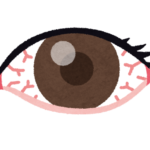 赤ちゃんや乳児の目やにの原因は?小児科で診察してもらい風邪による結膜炎と診断!